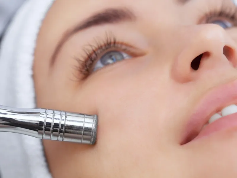 microdermabrasion or dermaplaning