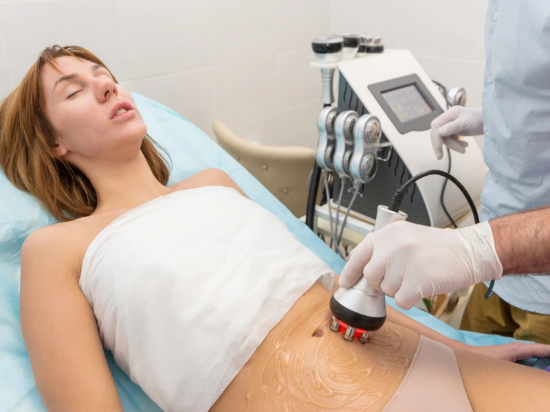 what is lipo cavitation and rf tightening services
