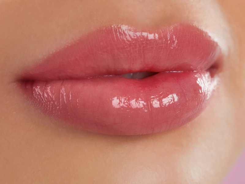 benefits of lip fillers