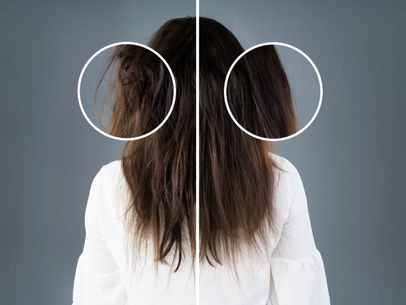 cost of PRP Hair Treatment