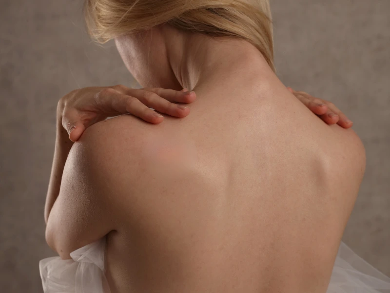 cost of skin tag removal